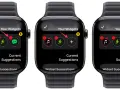 Schermata di un widget orologio su Apple Watch, mostra le opzioni per aggiungere o rimuovere icone di app.